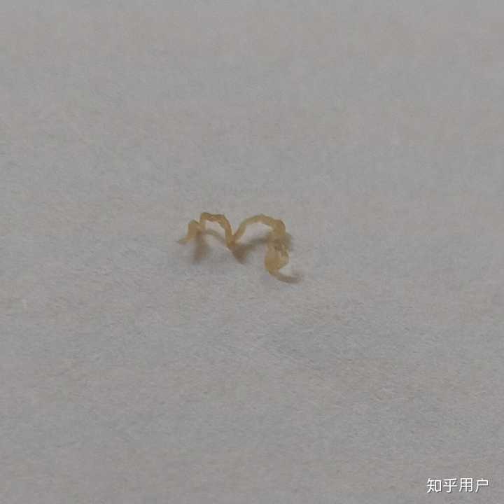 史上最大的黑头有多大?