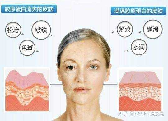 25 的女孩如何抗氧化,延缓衰老速度?