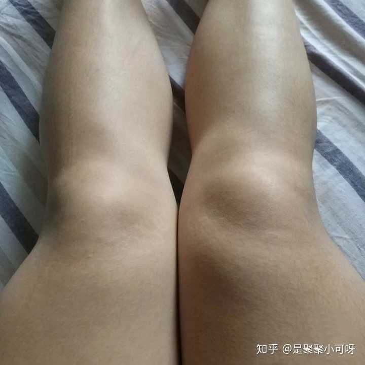 我来说说我是怎么瘦腿的吧 直接开始先看对比图 瘦腿前 瘦下来之后 我