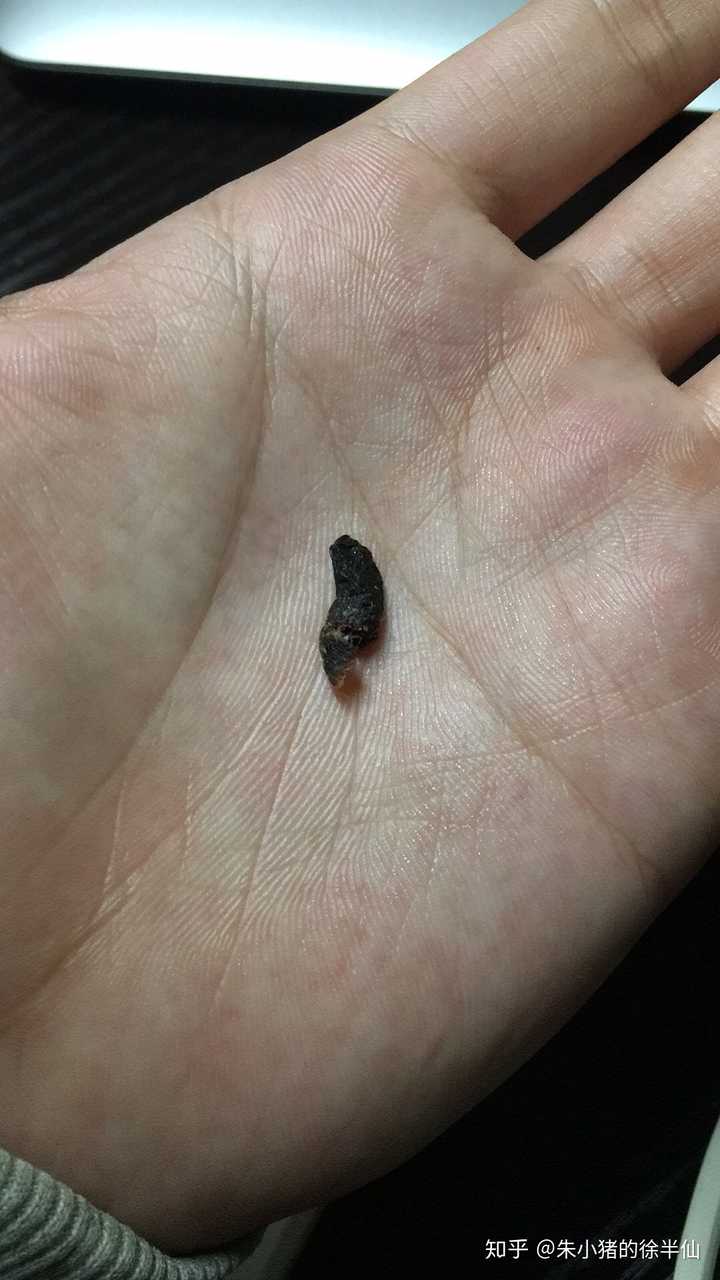 你呢耳朵痒痒吗?