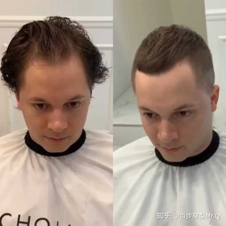 男士如何理适合自己的发型