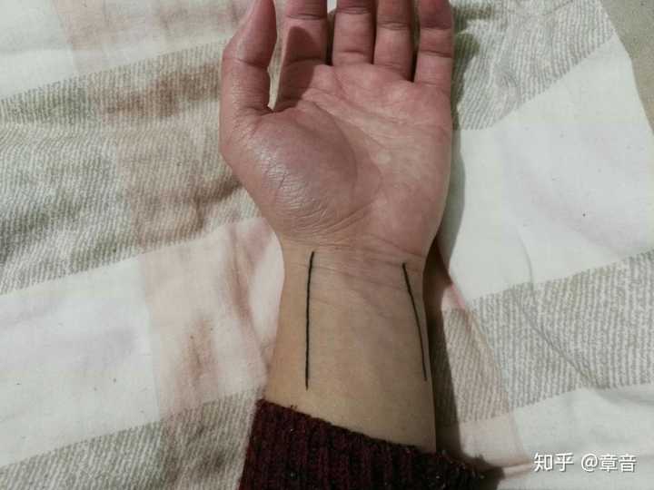 我把手腕上的挠动脉和尺动脉标了出来.