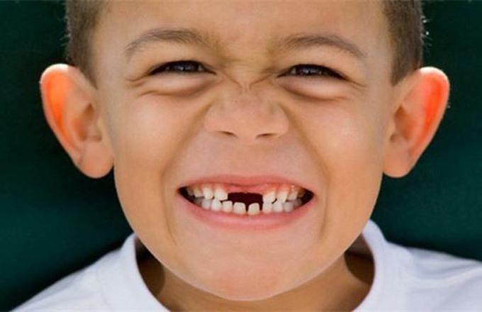 小孩换牙齿注意事项?