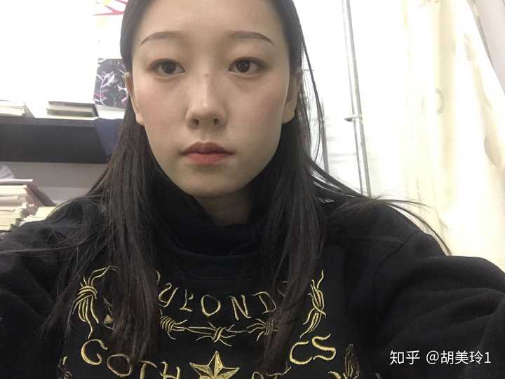 左右脸不对称怎么办?(带图)?