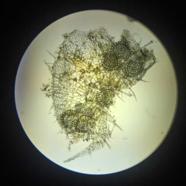 某种蕨类的孢子