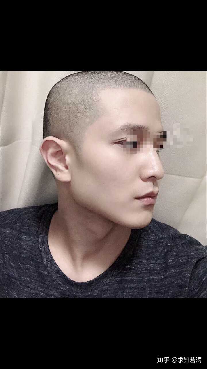 男女生后脑勺头扁是种什么体验?
