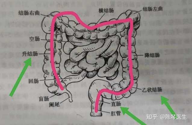 差不多占了所有大肠癌的一半,接着就是升结肠和乙状结