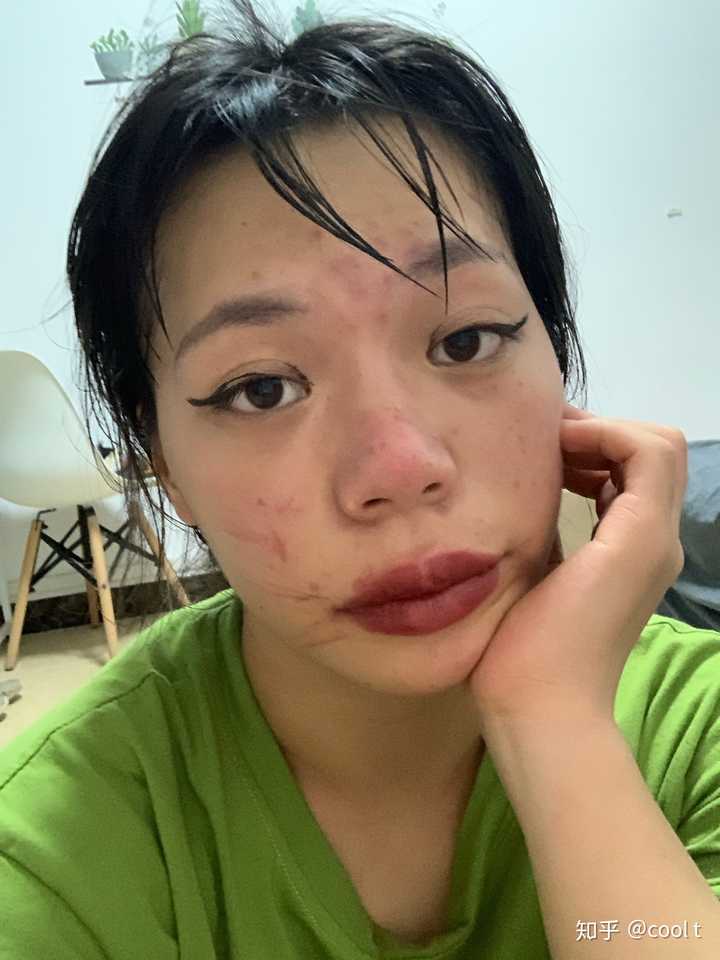 女生长得特别丑怎么办?