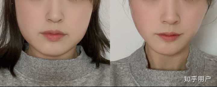 我的咬肌好大,我想瘦下来,怎么瘦,不整容不开刀的情况