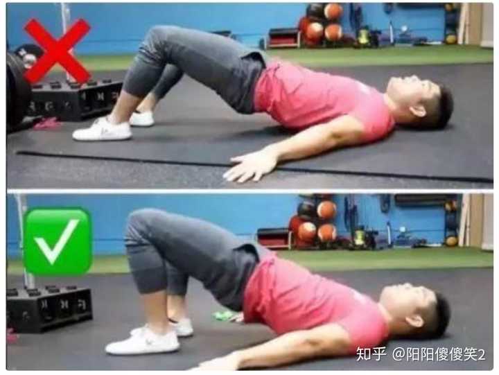 腰部过度反弓
