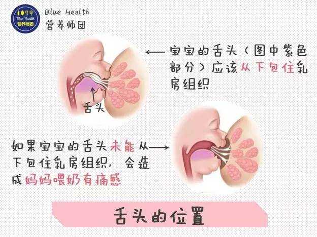 作为一个新妈妈,喂奶乳头被吸得很痛,但仍打算忍痛亲喂,怎样克服喂奶