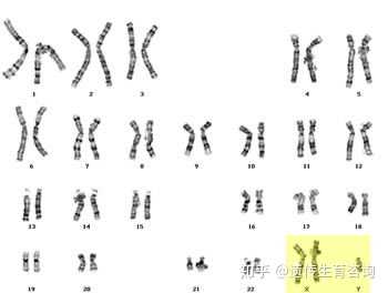 形成xxy染色体可能有哪些情况?