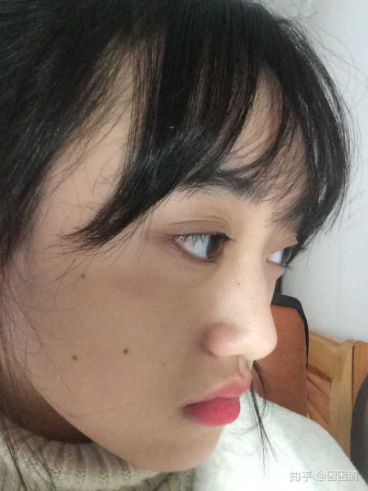 眼睛太凸怎么办?