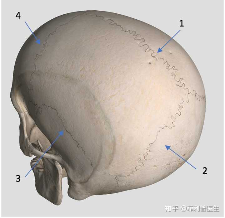 不难看出,围成颅腔的骨头——左右顶骨,枕骨和额骨之间形成了显著的