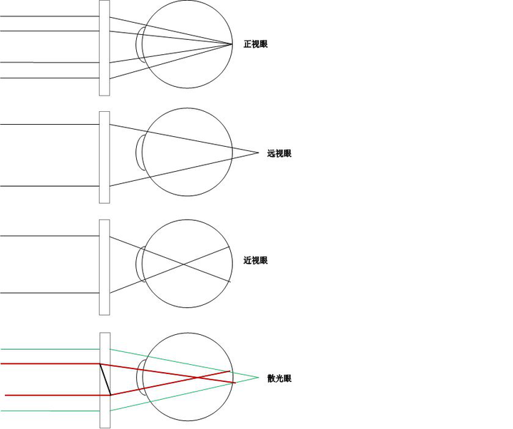 近视就是光线的焦点成像在底片之前,远视就是底片之后,而散光就是镜头