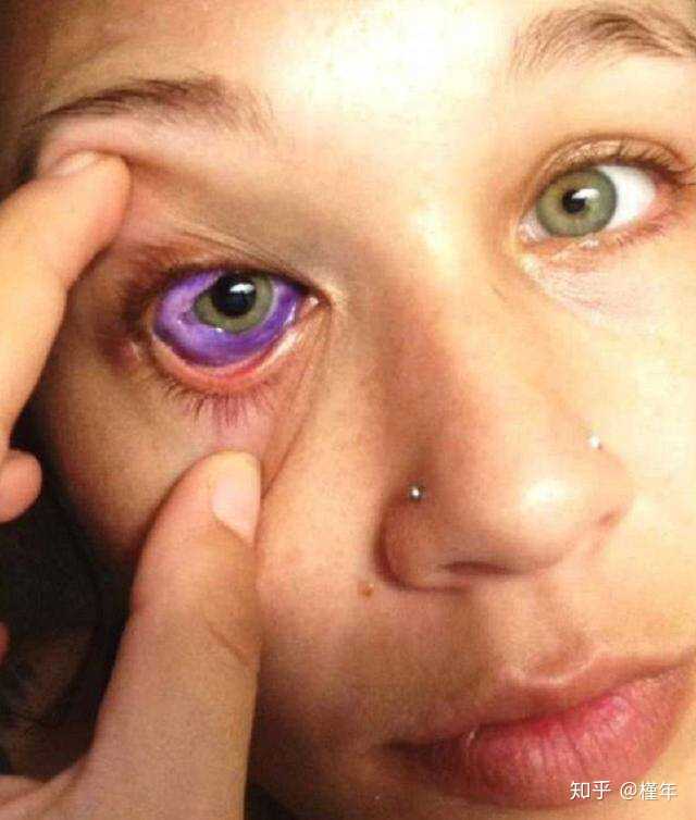 最独特的眼睛颜色是什么?