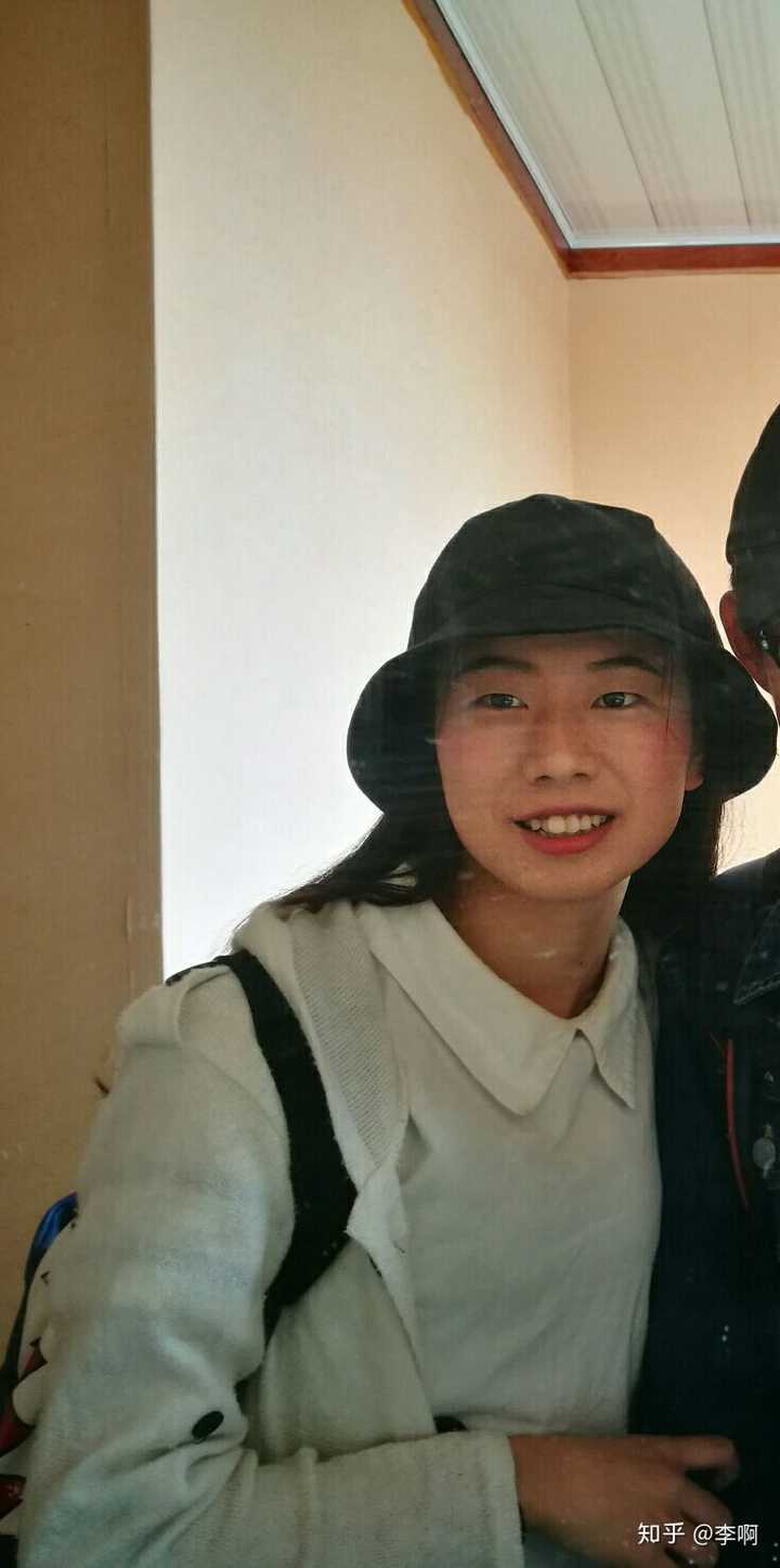 25岁后去矫正牙齿戴牙套是什么体验