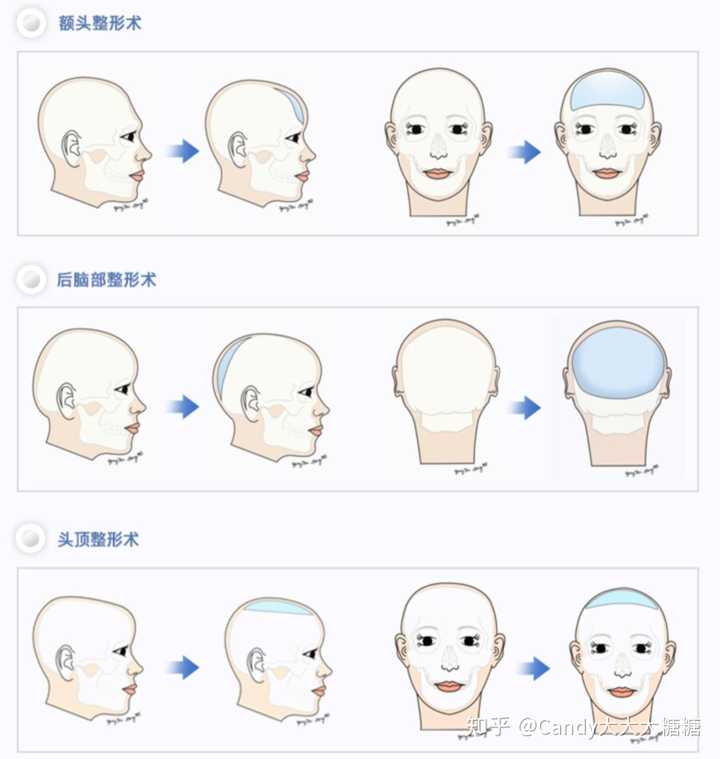 大扁头怎样变圆头啊