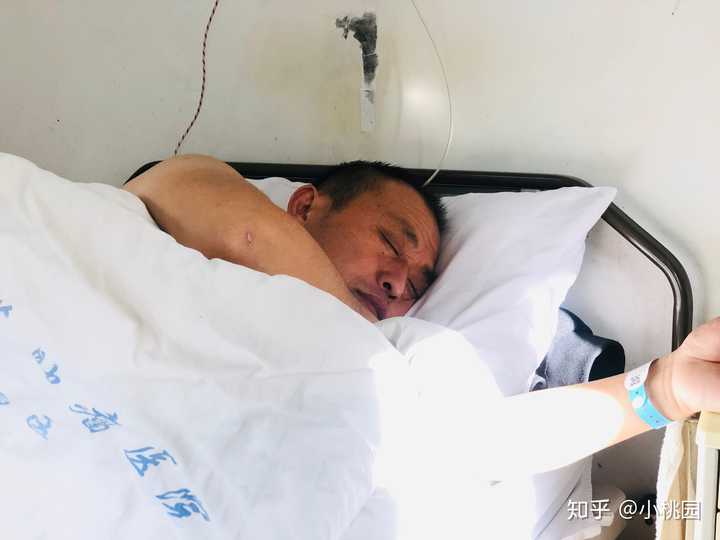 你知道的胰腺癌患者都活了多久