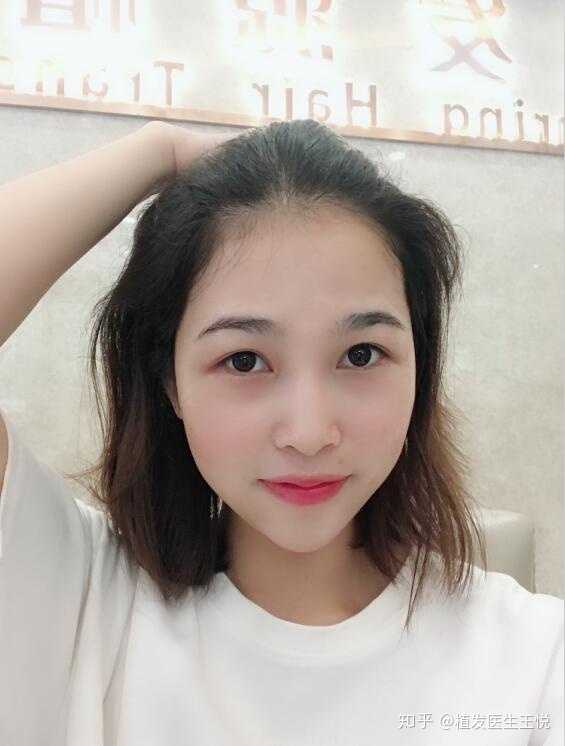 秃头少女适合烫什么发型?