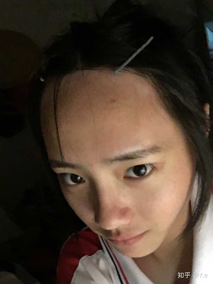 女生发际线特别高是怎样的体验?