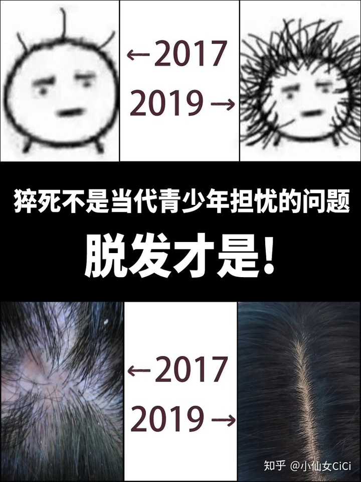 秃头少女两年抗战史