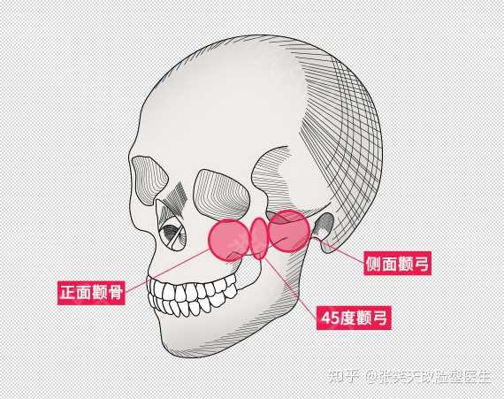 在整形美容的定义中,怎么判断颧弓是不是过高?