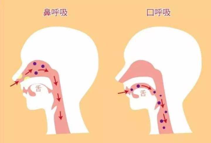 「口呼吸」对健康与面容有何影响,如何科学预防与矫正?