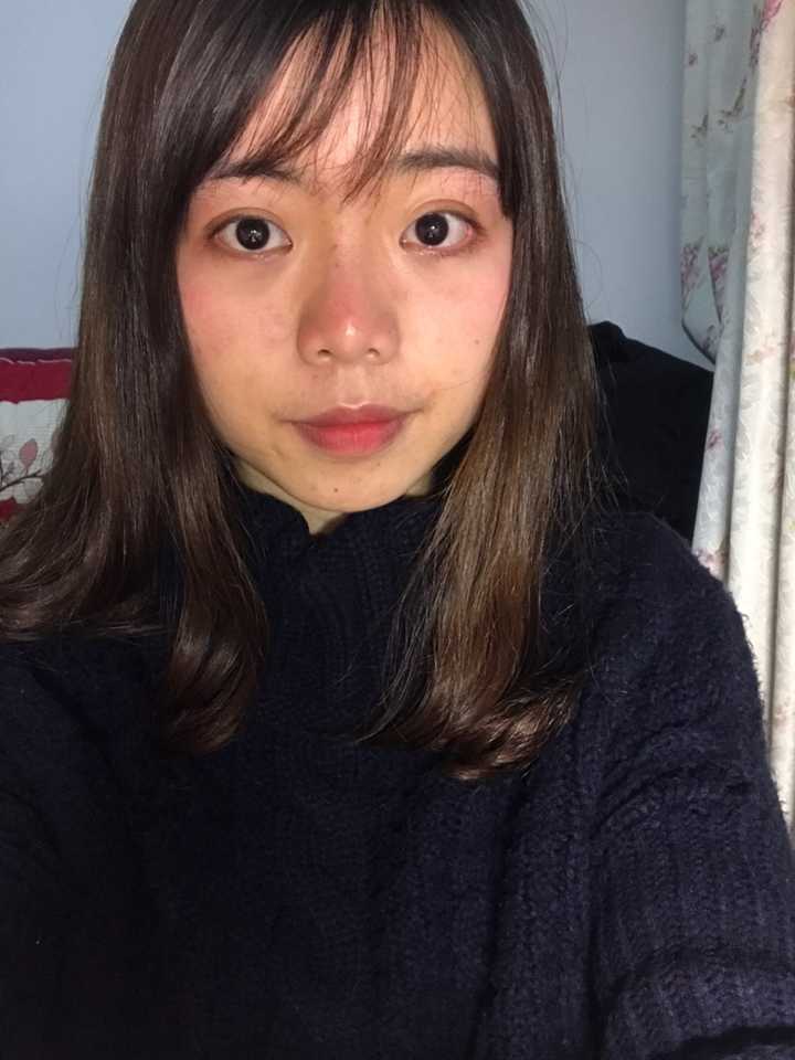 怎么看待五官漂亮但是皮肤差的女性?