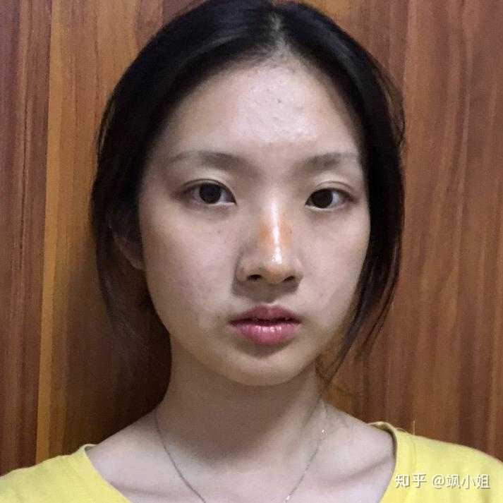 鼻子塌的女孩怎样由丑变美?