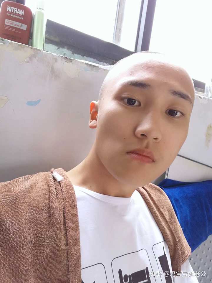 发际线很高的男人适合什么样的发型?