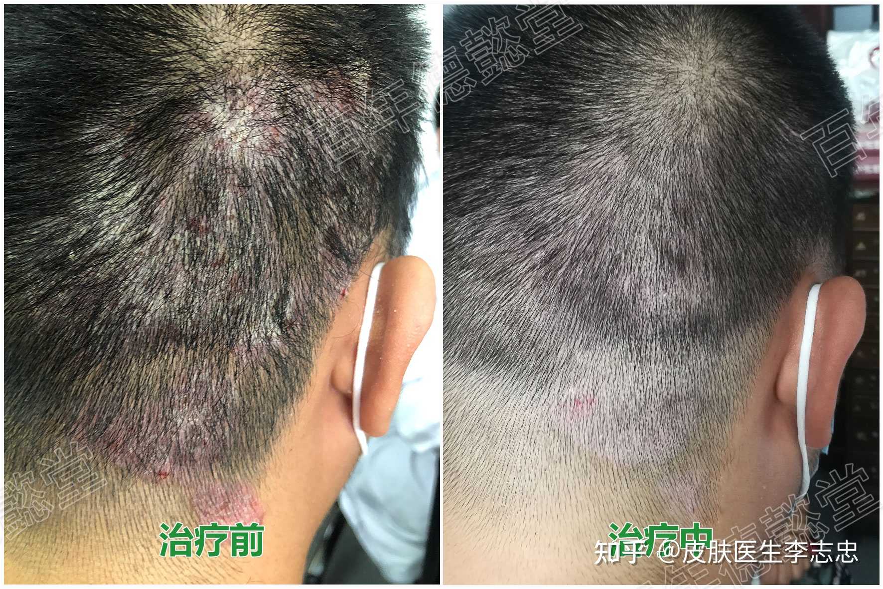 皮肤医生李志忠