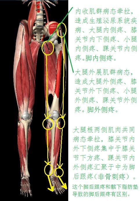 下面就单说大腿内收肌群劳损后的病理损害.