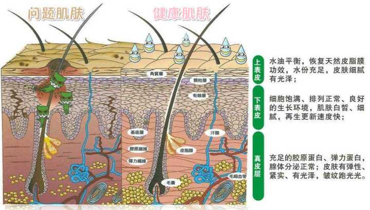 所以, 皮肤不同部位(表皮表层,表皮深层,真皮层) 的代谢失衡,都会造成