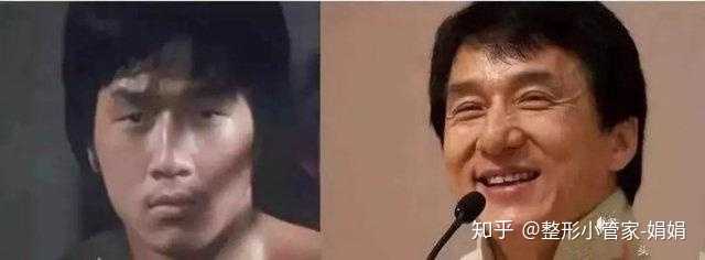 你觉得单眼皮好看还是双眼皮好看?