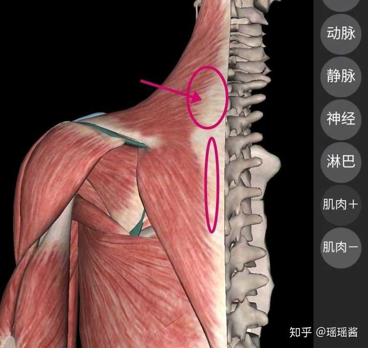 左肩胛骨突出,趴着的时候明显左高右低,左肩的肌肉疼痛.