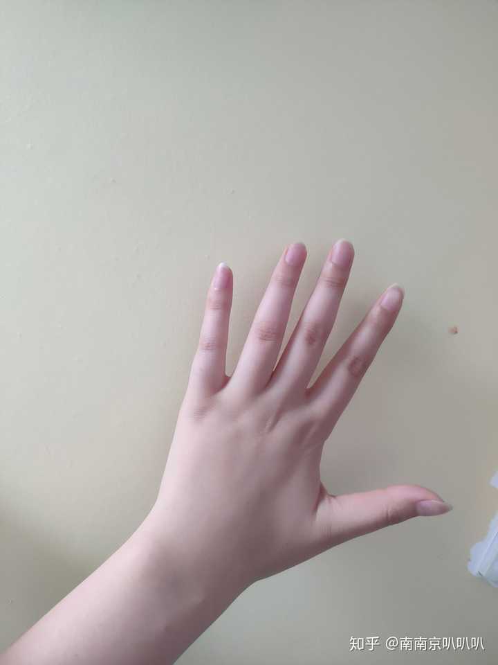 我的手愣是长的像八百斤的手 我的朋友们都叫它…猪蹄