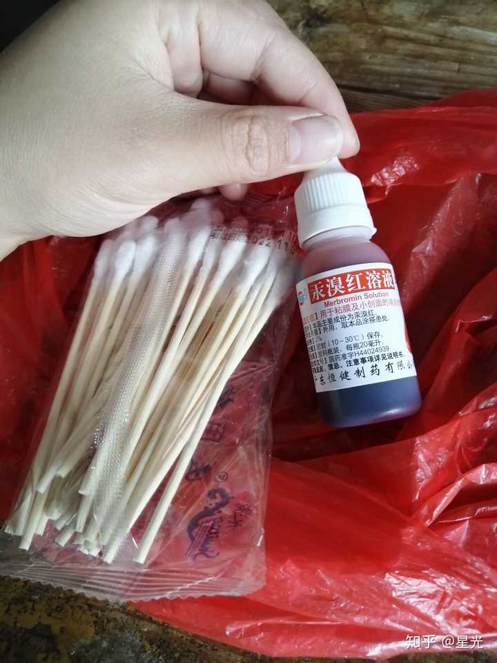 骑车侧翻膝盖摔伤破皮,怎么处理伤口,怎样才能不留疤?