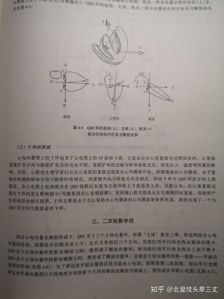 心电向量图与心电图的关系?