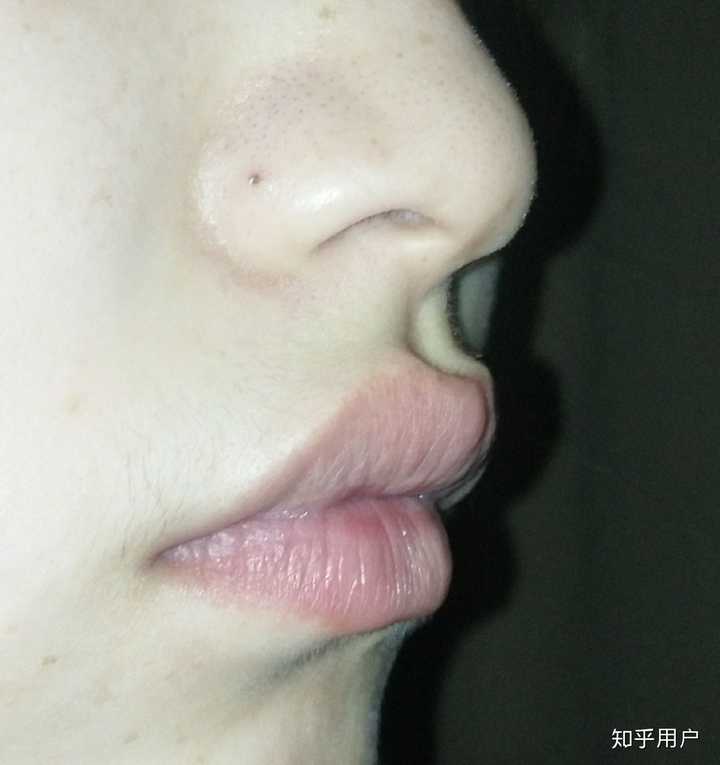 嘴唇厚且翘是什么体验?