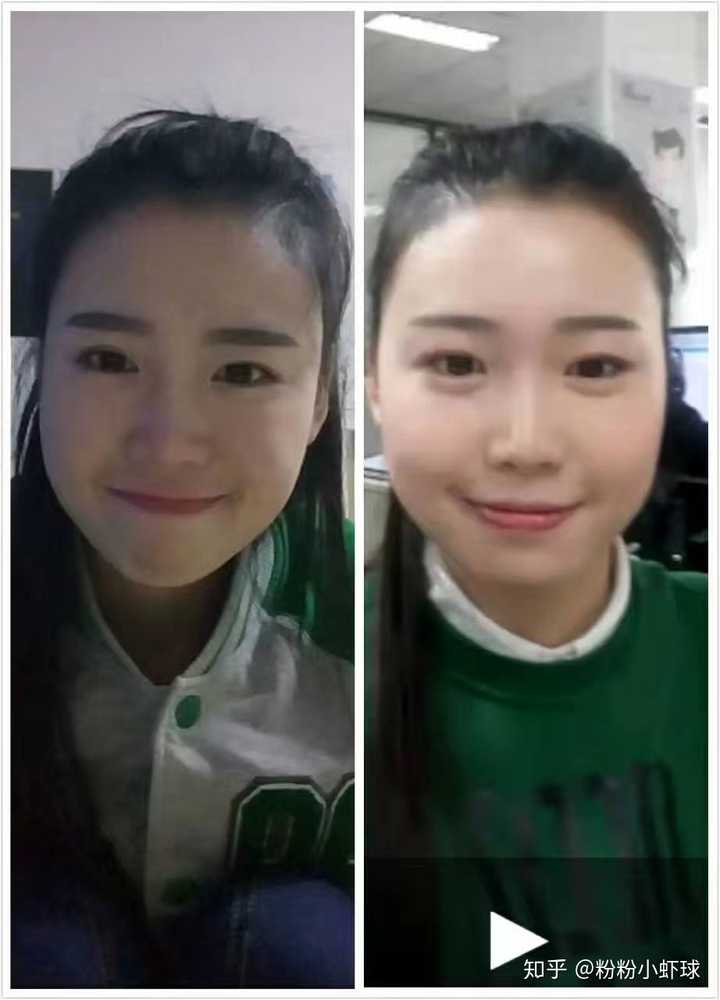 可以直观的感受到瘦了以后眼睛都变大了