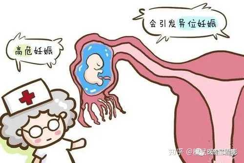 又发生再一次人流,会使得内分泌发生紊乱,影响内分泌系统的正常生理