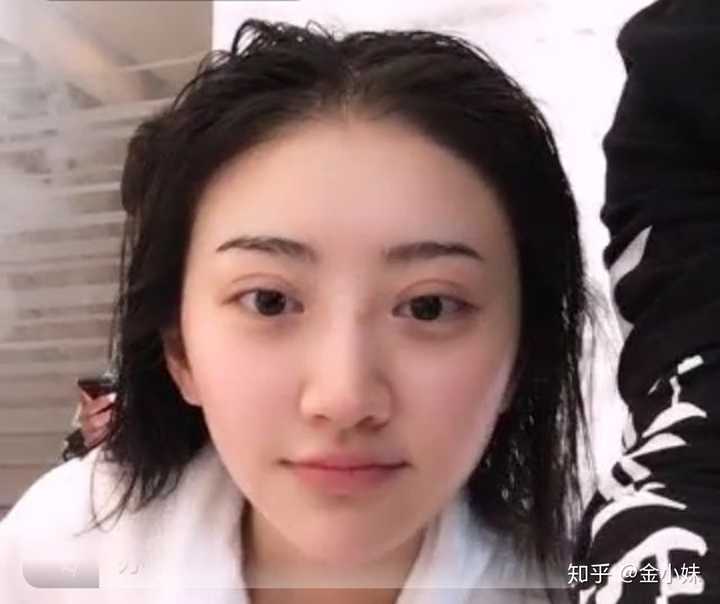 不过她前段时间出席活动时,双眼皮明显变窄了,前后对比还是蛮明显的