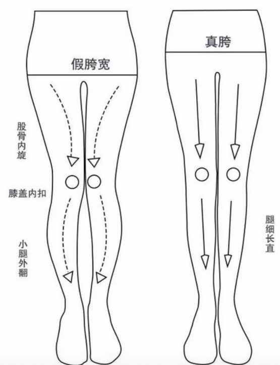 假胯臀很明显的特征就是:大腿根部的地方突出,比臀部的位置宽!
