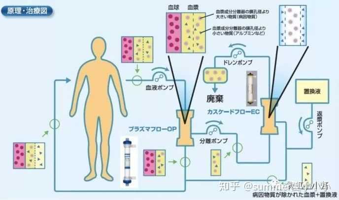 传统透析中运用的血液净化技术,在排除血液中杂质的同时,也会排除有用