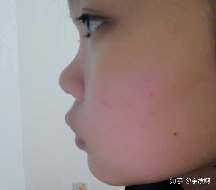 女生塌鼻子是种怎样的体验?