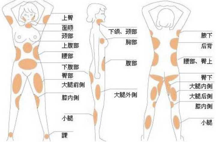 求问想做大腿抽脂手术要准备多少钱?