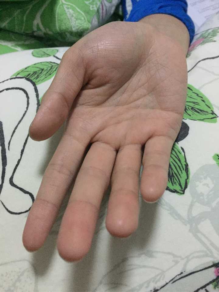 我也是一个手控,虽然我的手很丑,但是我觉得我老公的手很好看.