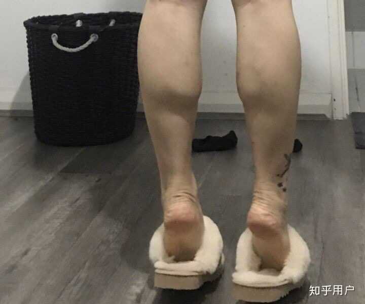 腿上的软肉怎么减?