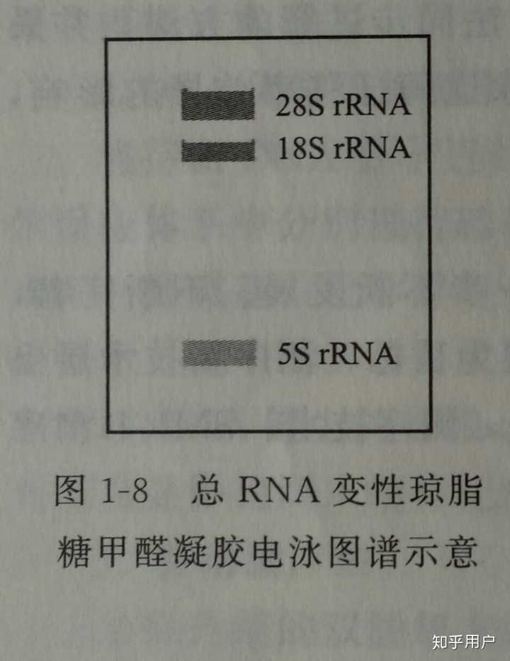不知道你们看得懂不~) 上图是真核生物提取rna,通过琼脂糖凝胶电泳跑